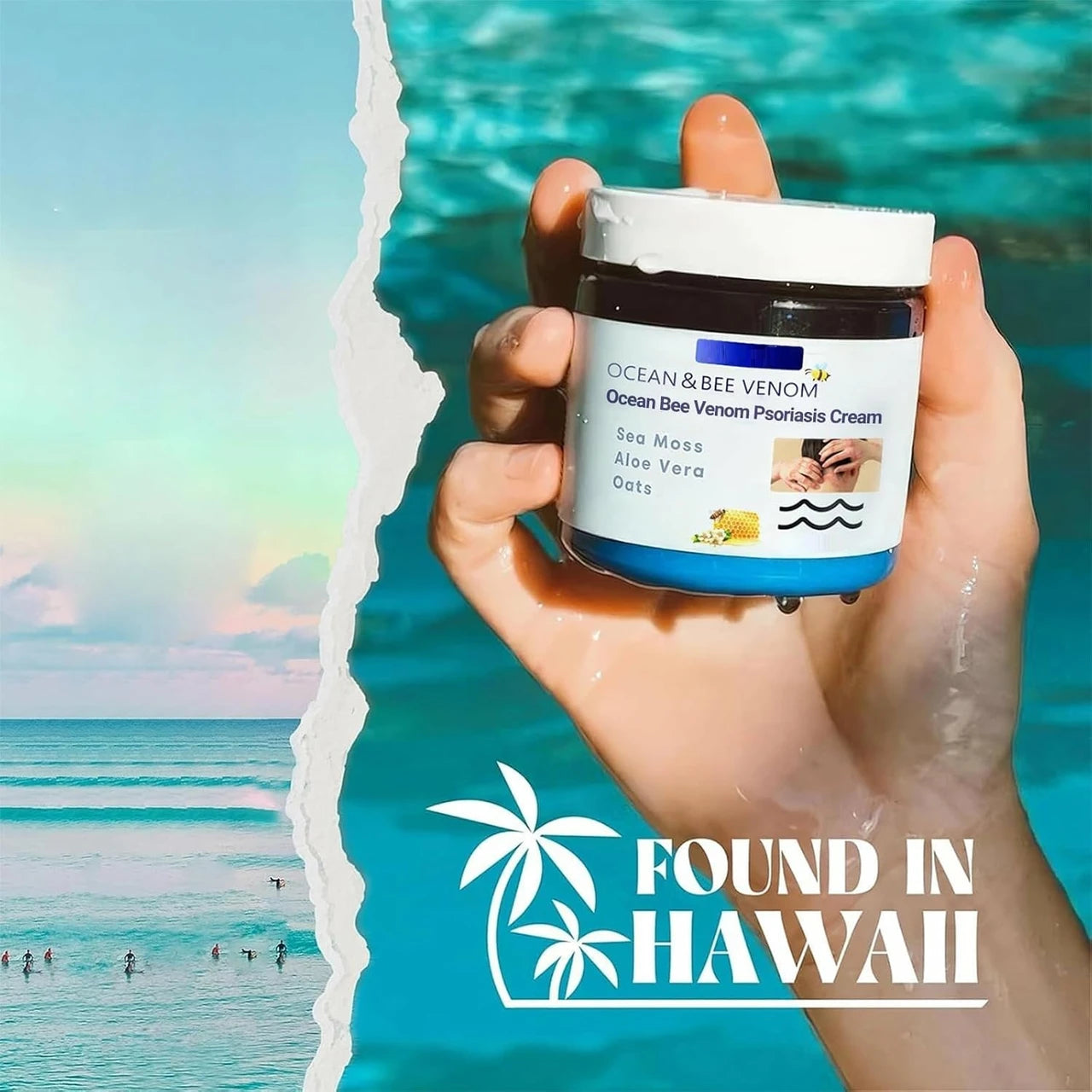 Bee Venom & Ocean Psoriasis Healing Cream (Pack Of 2)